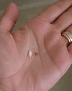 Smallest human bone size (photo 2 of 2)