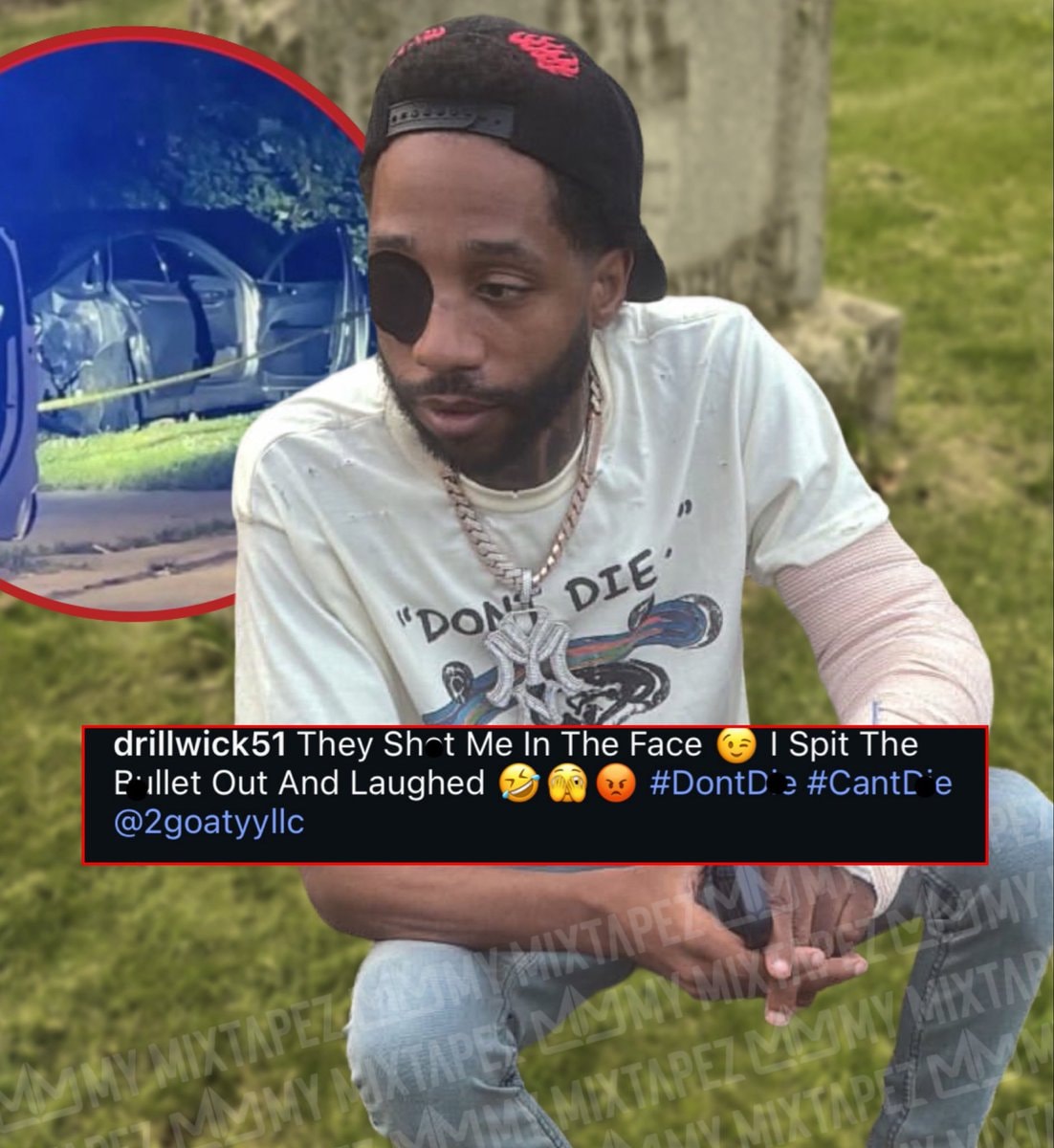 Drilla reflects on being shot in the eye Drilla reflects on being shot in the eye