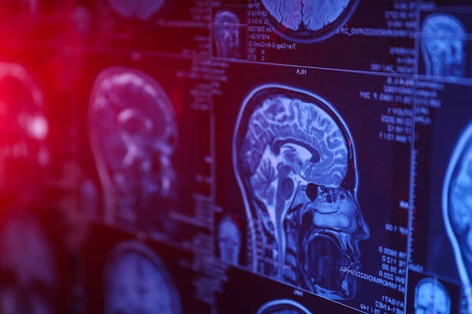 Quantum entanglement in the brain (photo 2 of 2)