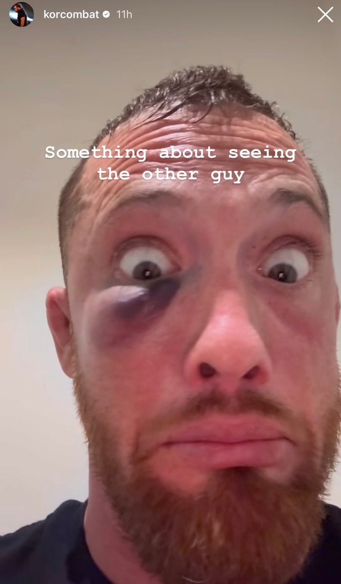 Kyle O'Reilly black eye AEW Dynamite