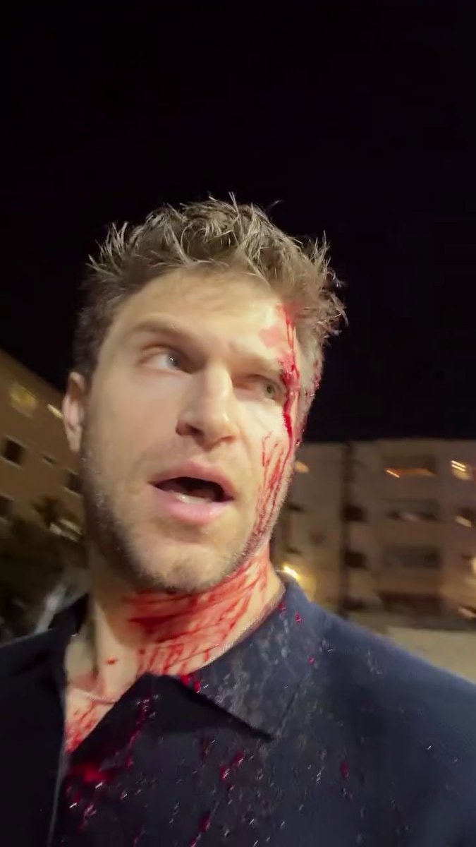 Keegan Allen assault aftermath