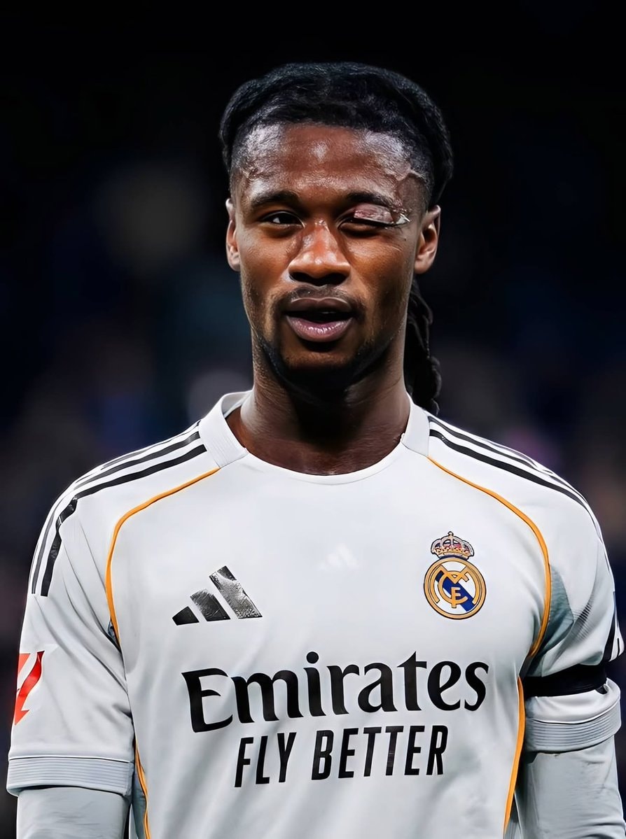 Eduardo Camavinga Real Madrid injury (photo 1 of 2)