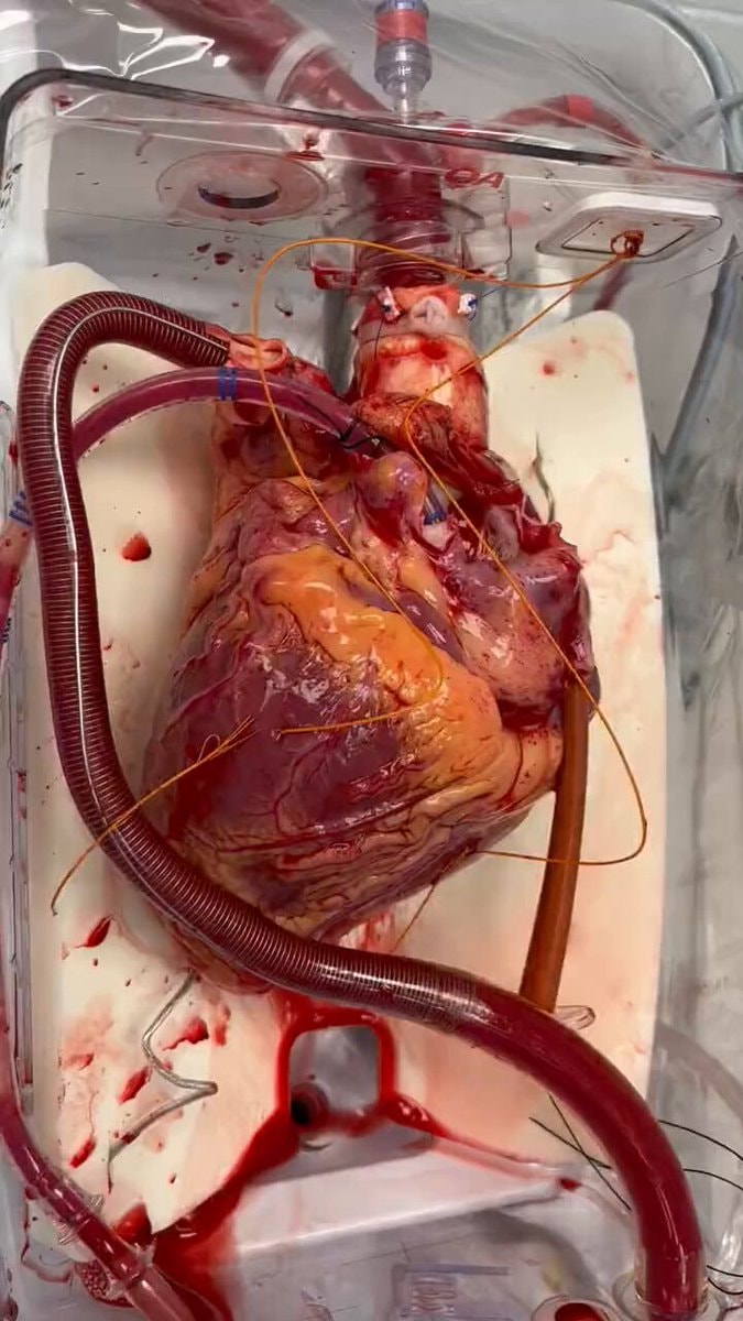 Heart beating outside the body