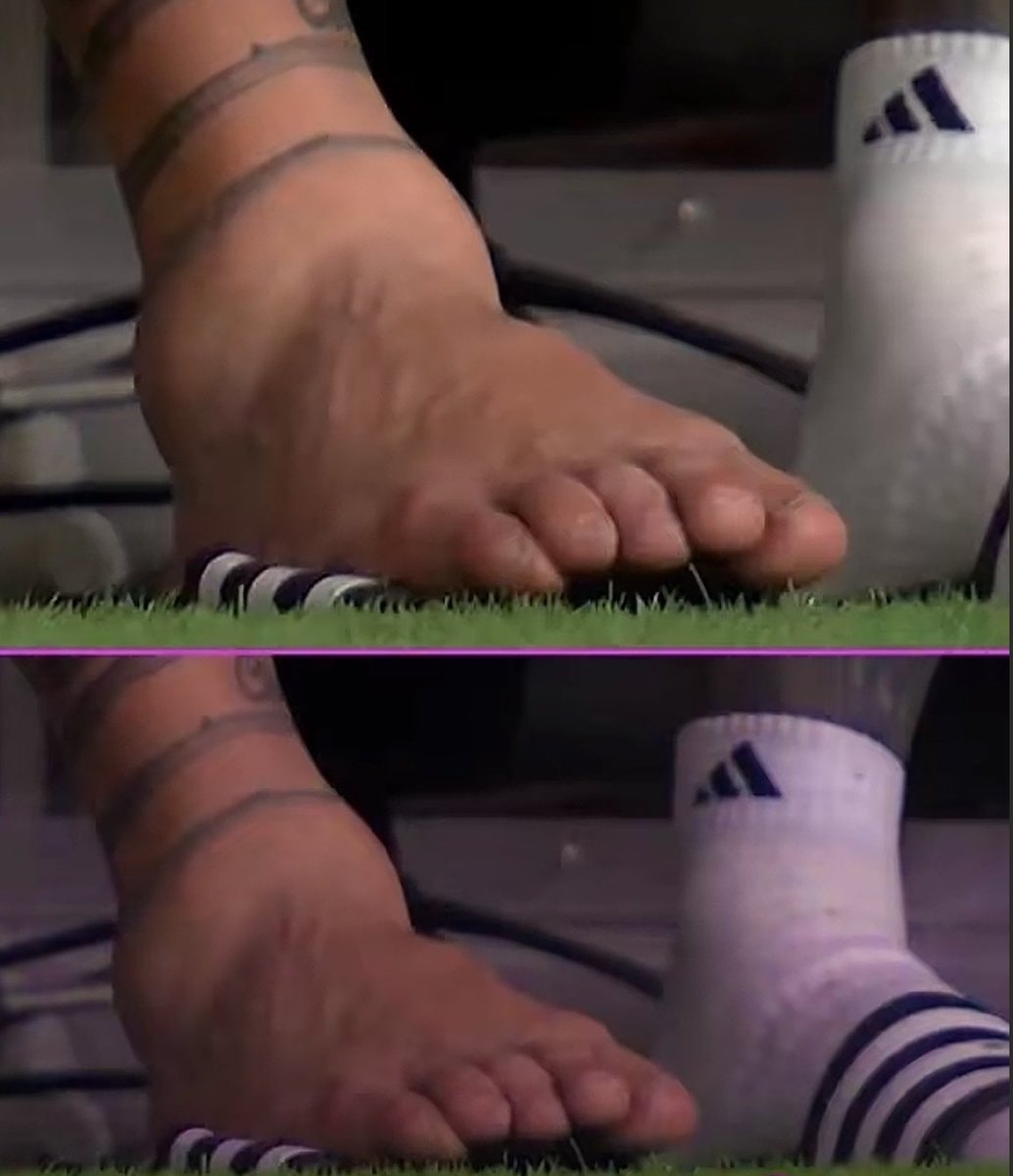 Messi ankle Copa America final 🚨